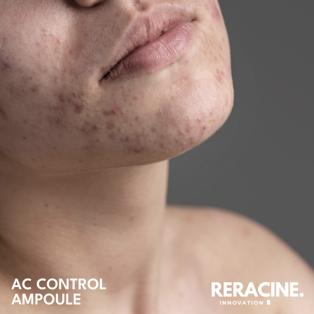 Reracine A.C. Control Ampoule